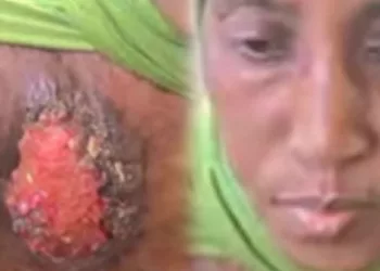 Aissatou Baldé, le cri d’une mère dévastée par le cancer du sein