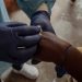 Mpox en Guinée : l’épidémie progresse avec 271 cas confirmés