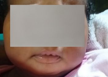 Le bébé volé à Kissosso retrouvé, la présumée ravisseuse interpellée par la police